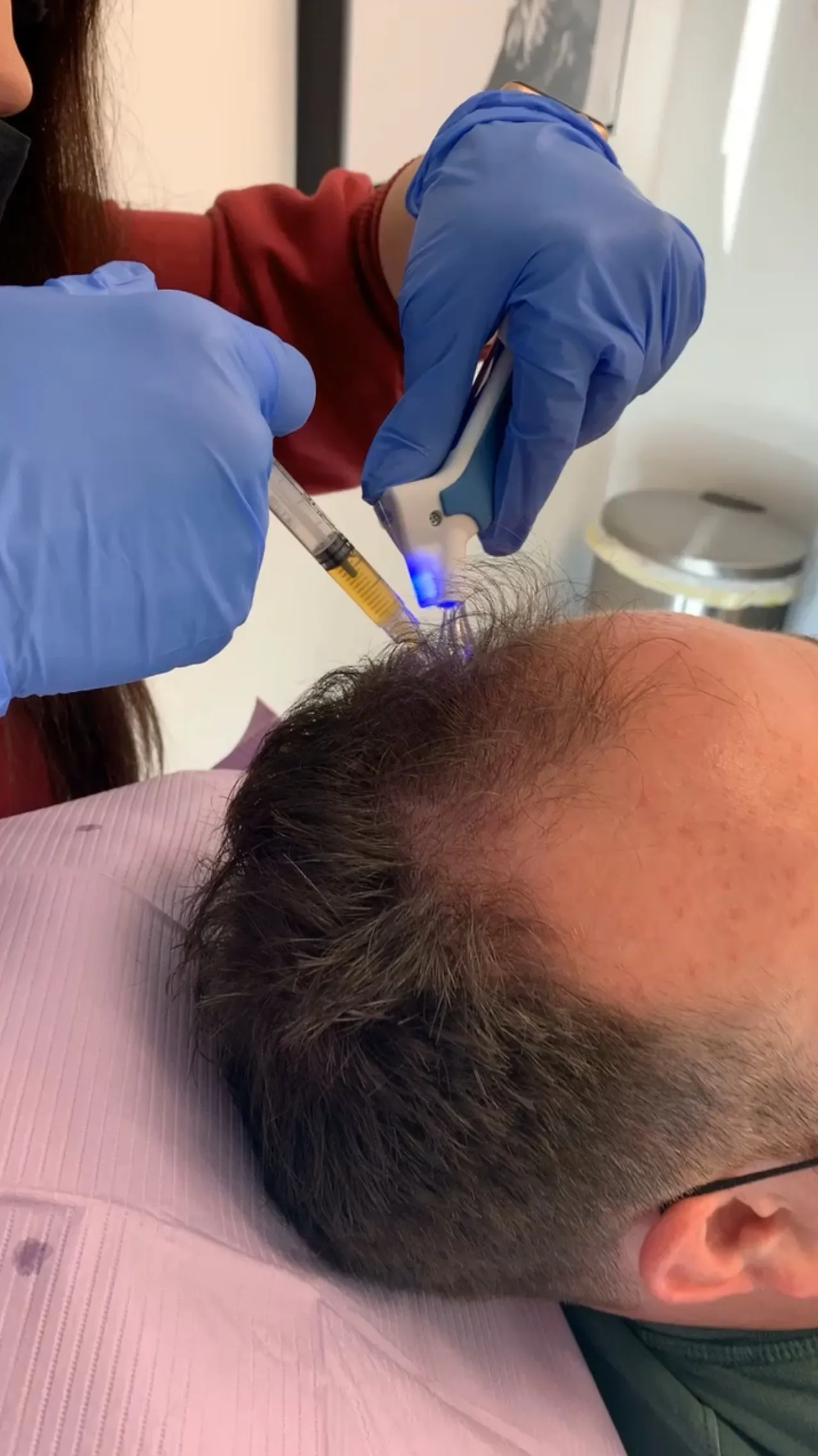 PRP Hair Restoration Omega Aesthetics Wellness in Farmington UT