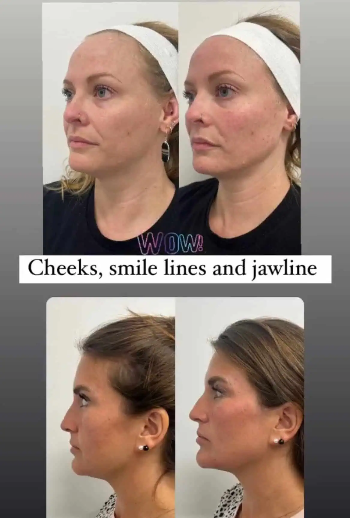 Facial-balancing